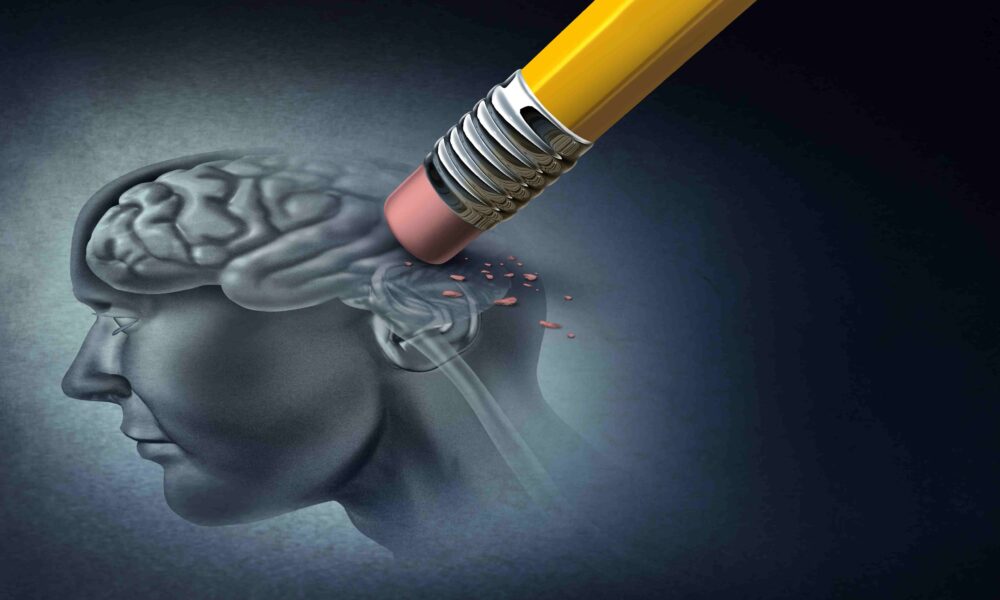 - Seven Stages of Alzheimers Disease 11zon