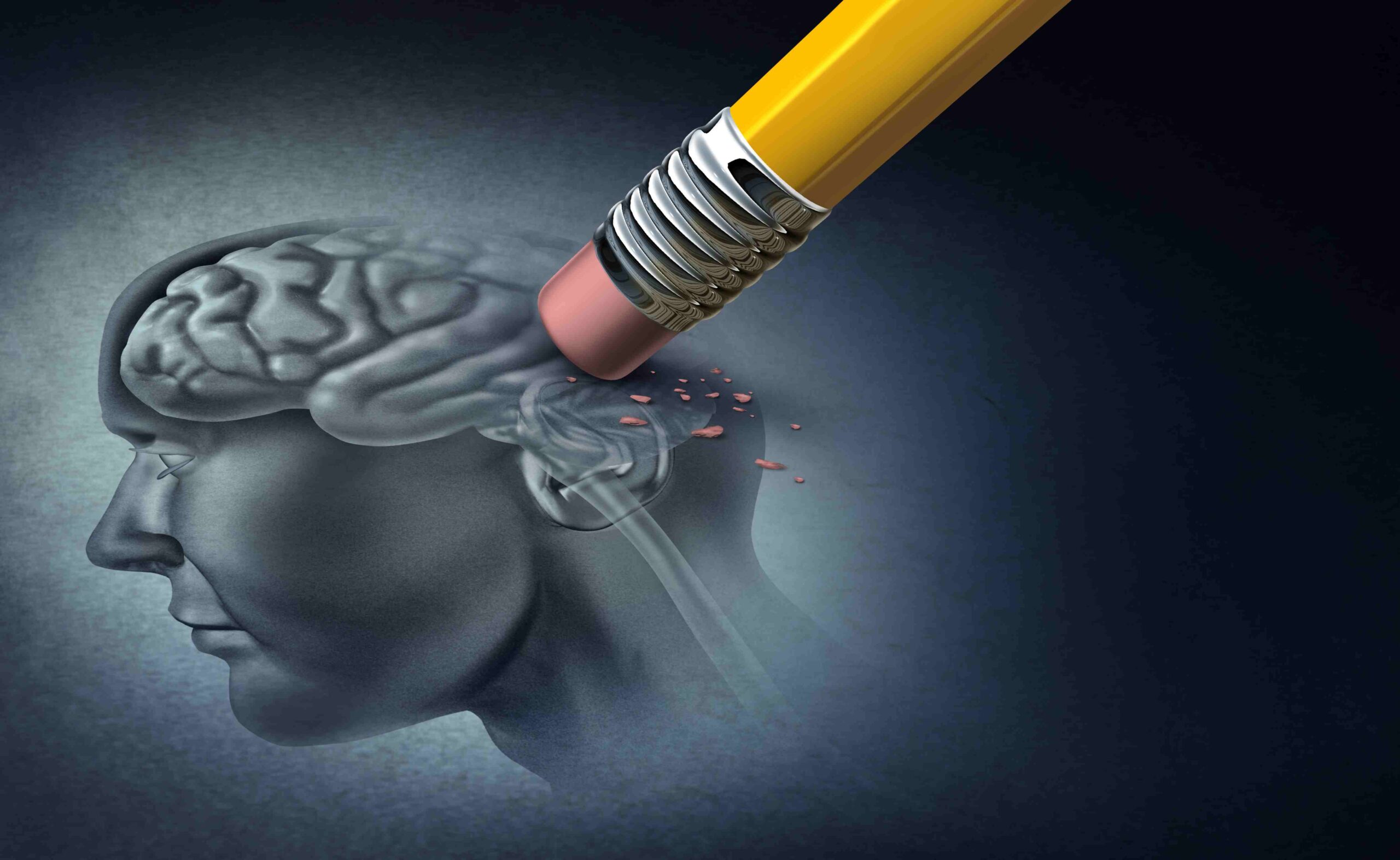 - Seven Stages of Alzheimers Disease 11zon scaled